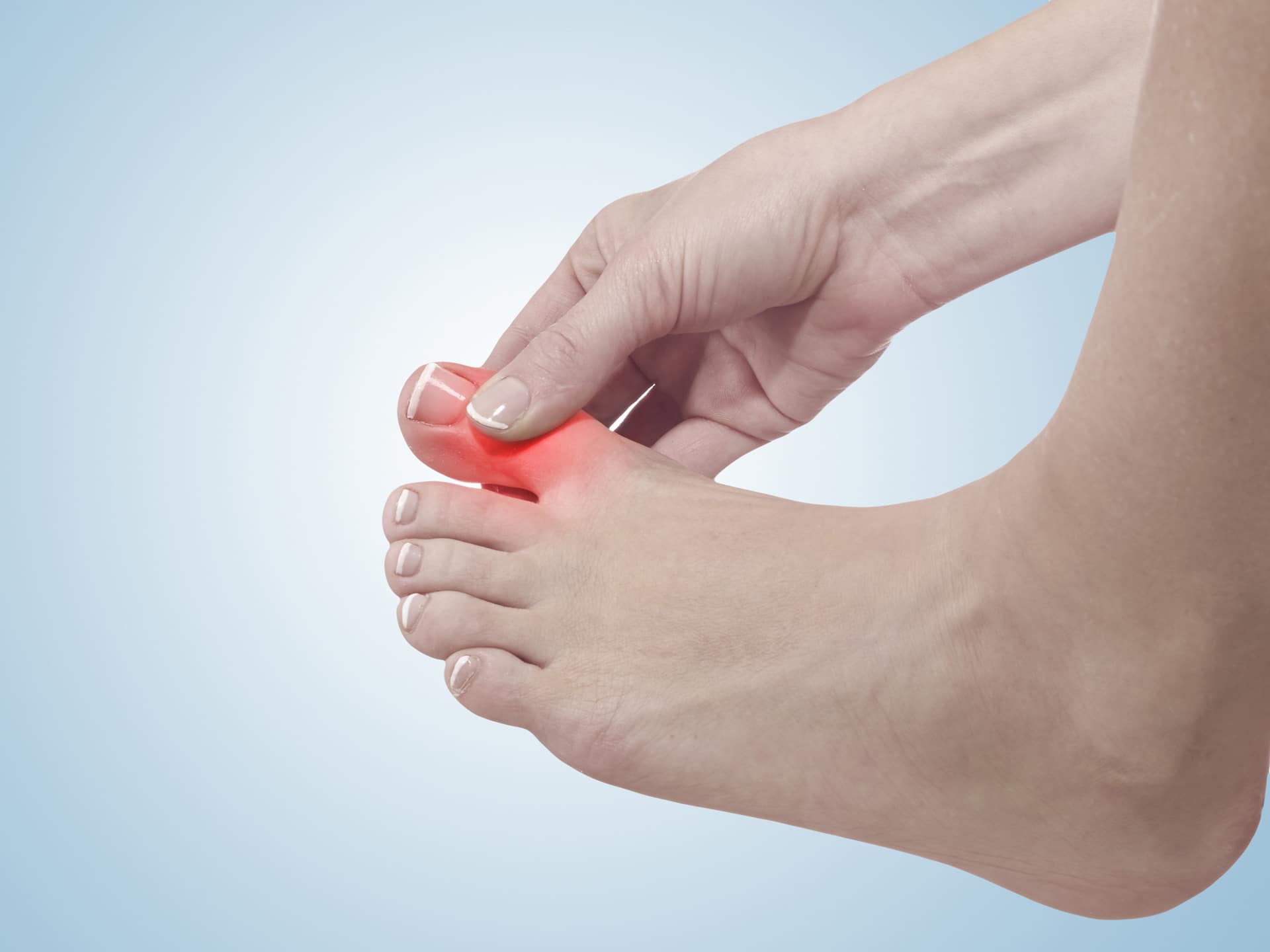 Hallux rigidus: Versorgung bei eingeschränkter Großzehenbeweglichkeit