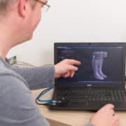 Digitaler Aufbau einer Lymph- und Lipödemversorgung bei Priwitzer